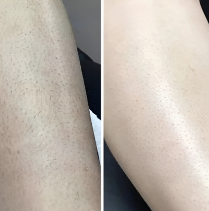 Elysia Ladyshave Dames - Draadloos Elektrisch Scheerapparaat voor Gevoelige Huid